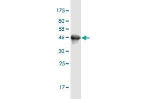 Western Blot detection against Immunogen (45. (UBALD1 抗体  (AA 1-177))