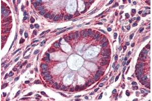 Anti-MMP14 antibody IHC of human colon. (MMP14 抗体  (AA 160-173))