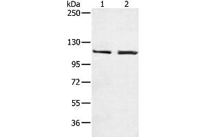 Western Blotting (WB) image for anti-Telomerase Reverse Transcriptase (TERT) antibody (ABIN2426079) (TERT 抗体)