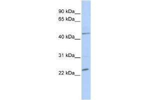 WB Suggested Anti-NKX3-1 Antibody Titration:  0. (NKX3-1 抗体  (Middle Region))