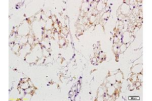 Formalin-fixed and paraffin embedded mouse stomach labeled with Anti-EGFRvIII Polyclonal Antibody, unconjugated  (ABIN742035) at 1: 200 followed by incubation with conjugated secondary antibody and DAB staining (EGFRviii 抗体  (AA 1-50))
