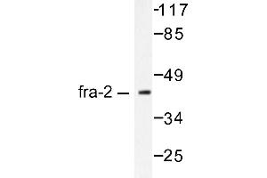 Image no. 1 for anti-FOS-Like Antigen 2 (FOSL2) antibody (ABIN265424) (FOSL2 抗体)