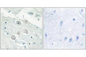 Immunohistochemistry analysis of paraffin-embedded human brain tissue, using JAK1 Antibody. (JAK1 抗体  (AA 91-140))