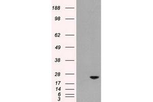 HEK293T cells were transfected with the pCMV6-ENTRY control (Left lane) or pCMV6-ENTRY AK1 (Right lane) cDNA for 48 hrs and lysed. (Adenylate Kinase 1 抗体)