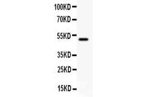 Anti- CD80 antibody, Western blottingAll lanes: Anti CD80  at 0. (CD80 抗体  (C-Term))