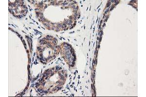 Immunohistochemical staining of paraffin-embedded Human breast tissue using anti-HARS2 mouse monoclonal antibody. (HARS2 抗体)