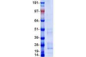 Western Blotting (WB) image for Bone Marrow Stromal Cell Antigen 2 (BST2) protein (Myc-DYKDDDDK Tag) (ABIN2713638)