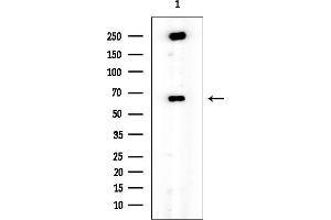 anti-MRS2 Magnesium Homeostasis Factor Homolog (MRS2) antibody