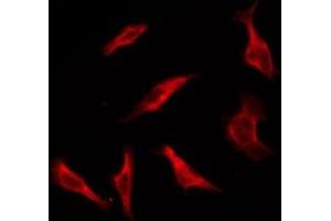 ABIN6276125 staining HT29 by IF/ICC. (OR1S1/1S2 抗体)