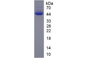 SDS-PAGE analysis of Human PFKM Protein. (PFKM 蛋白)