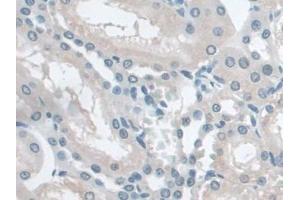 DAB staining on IHC-P; Samples: Rat Kidney Tissue (Butyrylcholinesterase 抗体  (AA 345-570))