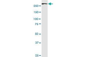 FASN monoclonal antibody (M02), clone 3B3-1D6. (Fatty Acid Synthase 抗体  (AA 1-439))