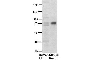WB Suggested Anti-PFKL Antibody Titration:  5% Milk  ELISA Titer:  dilution: 1:500  Positive Control:  human LCL and mouse brains (PFKL 抗体  (Middle Region))