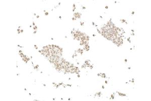 Immunocytochemistry (ICC) image for anti-AT Rich Interactive Domain 2 (ARID, RFX-Like) (ARID2) (AA 1785-1835) antibody (ABIN7449532)