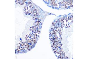Immunohistochemistry of paraffin-embedded mouse testis using DDX4 Rabbit pAb (ABIN7266705) at dilution of 1:100 (40x lens). (DDX4 抗体  (AA 1-300))