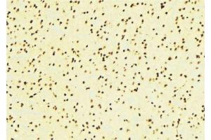 ABIN6276424 at 1/100 staining Mouse brain tissue by IHC-P. (ARNT 抗体  (N-Term))