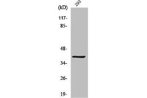 Western Blot analysis of 293 cells using MAGE-C2 Polyclonal Antibody (MAGEC2 抗体  (Internal Region))