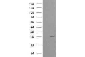 Image no. 6 for anti-Cytidine Monophosphate (UMP-CMP) Kinase 1, Cytosolic (CMPK1) antibody (ABIN1497544) (Cytidine Monophosphate (UMP-CMP) Kinase 1, Cytosolic (CMPK1) 抗体)