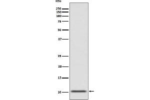 Western blot analysis of GLP1 expression in human fetal pancreas lysate.