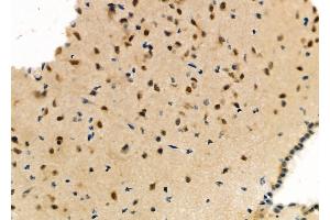 ABIN6263478 and ABIN6273142 at 1/100 staining Mouse brain tissue by IHC-P.