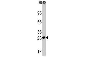 Western blot analysis of PSMA5 polyclonal antibody  in HL-60 cell line lysates (35 ug/lane). (PSMA5 抗体  (Internal Region))