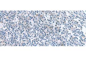 Immunohistochemistry of paraffin-embedded Human tonsil tissue using IL1B Polyclonal Antibody at dilution of 1:55(x200)