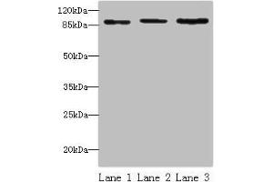 Western blot All lanes: STAT5B antibody at 16 μg/mL Lane 1: HepG2 whole cell lysate Lane 2: K562 whole cell lysate Lane 3: Hela whole cell lysate Secondary Goat polyclonal to rabbit IgG at 1/10000 dilution Predicted band size: 90 kDa Observed band size: 90 kDa (STAT5B 抗体  (AA 40-280))