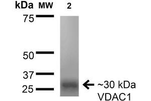 Western Blot analysis of Rat Brain Membrane showing detection of ~30 kDa VDAC1 protein using Mouse Anti-VDAC1 Monoclonal Antibody, Clone S152B-23 . (VDAC1 抗体  (AA 1-283) (PerCP))