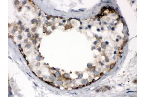 Immunohistochemistry (Paraffin-embedded Sections) (IHC (p)) image for anti-T-Complex 1 (TCP1) (AA 515-551), (C-Term) antibody (ABIN3043417) (TCP1 alpha/CCTA 抗体  (C-Term))