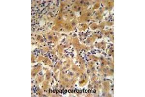 Immunohistochemistry (IHC) image for anti-Ceruloplasmin (Ferroxidase) (CP) antibody (ABIN3003152) (Ceruloplasmin 抗体)