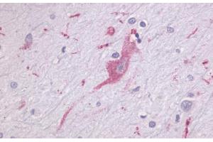 Anti-LPHN1 antibody  ABIN1049022 IHC staining of human brain, neurons and glia. (Latrophilin 1 抗体  (N-Term))