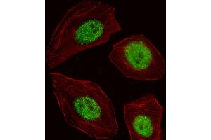 Fluorescent image of A549 cell stained with BLZF1 Antibody (Center) (ABIN653552 and ABIN2842935). (BLZF1 抗体  (AA 156-184))
