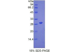 SDS-PAGE analysis of Mouse ANGPTL6 Protein. (ANGPTL6 蛋白)