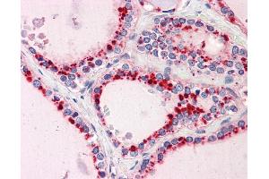 IHC Information: Paraffin embedded thyroid tissue, tested with an antibody dilution of 5 ug/ml. (RYBP 抗体  (N-Term))