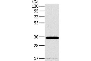 Western blot analysis of Mouse brain tissue, using OTUB1 Polyclonal Antibody at dilution of 1:800 (OTUB1 抗体)