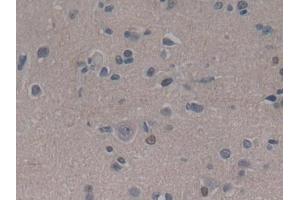 Detection of ABCC8 in Human Cerebrum Tissue using Polyclonal Antibody to ATP Binding Cassette Transporter C8 (ABCC8) (ABCC8 抗体  (AA 679-929))