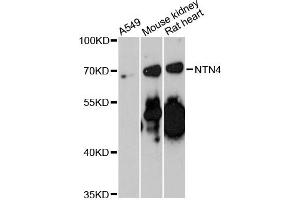Western blot analysis of extracts of various cell lines, using NTN4 antibody (ABIN6290686) at 1:3000 dilution. (Netrin 4 抗体)