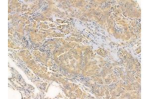 anti-THO Complex 5 (THOC5) (Internal Region) antibody