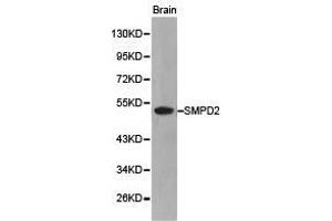Western Blotting (WB) image for anti-Sphingomyelin phosphodiesterase 2, Neutral Membrane (Neutral Sphingomyelinase) (SMPD2) antibody (ABIN1874877) (SMPD2 抗体)