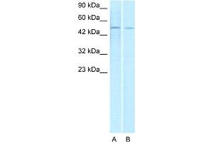 WB Suggested Anti-ERG Antibody Titration:  1. (ERG 抗体  (Middle Region))