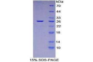 SDS-PAGE analysis of Mouse Nucleoporin 133 kDa Protein. (NUP133 蛋白)