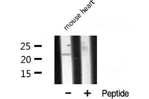 Western blot analysis of CLDN7 expression in Mouse Heart lysate (Claudin 7 抗体  (C-Term))
