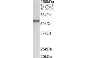 Western Blotting (WB) image for anti-serine/threonine Kinase 38 (STK38) (AA 420-431) antibody (ABIN1104516) (STK38 抗体  (AA 420-431))