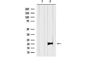 Western blot analysis of lysates from Mouse liver, using KRAS Antibody.