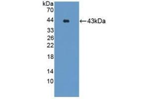 Detection of Recombinant GRPR, Mouse using Polyclonal Antibody to Gastrin Releasing Peptide Receptor (GRPR) (GRPR 抗体)