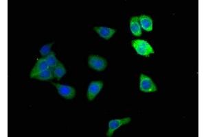 Immunofluorescence staining of HepG2 cells with ABIN7143645 at 1:166, counter-stained with DAPI. (ADH1B 抗体  (AA 2-375))