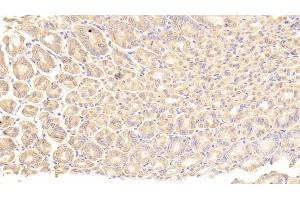 Immunohistochemistry (IHC) image for anti-alpha-Fetoprotein (AFP) (AA 399-605) antibody (ABIN7429541)