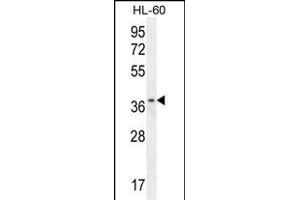 ZNF322B Antibody (C-term) (ABIN655350 and ABIN2850482) western blot analysis in HL-60 cell line lysates (35 μg/lane). (ZNF322P1 抗体  (C-Term))
