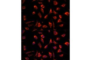 Immunofluorescence analysis of L929 cells using TCTP/TCTP/TPT1 antibody  at dilution of 1:100. (TPT1 抗体  (AA 1-172))