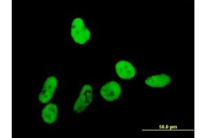 Immunofluorescence of purified MaxPab antibody to GTF2I on HeLa cell. (GTF2I 抗体  (AA 1-976))